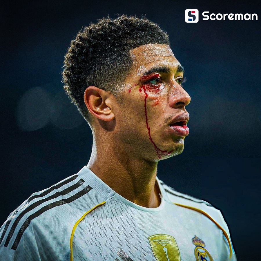 '음바페+비니시우스 투톱 실패→3명 퇴장' 레알 마드리드, 셀타 비고에 0-2 완패→맨시티전 앞두고 초비상